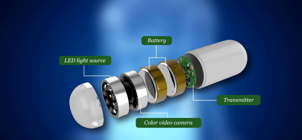 Capsule Endoscopy